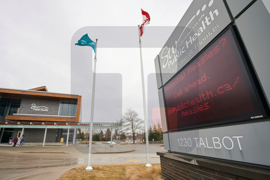 PAHO: Kanada izgubila status zemlje u kojoj su iskorenjene male boginje