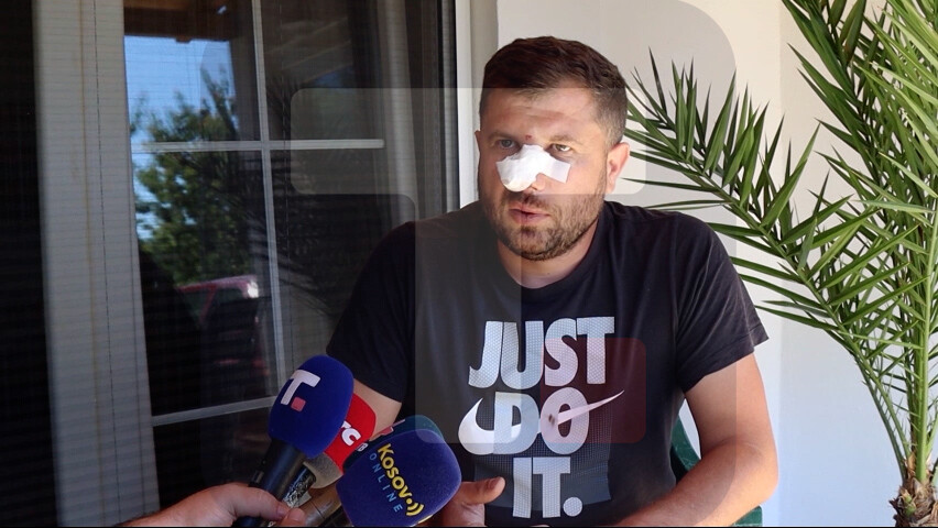 Napadnuti Srbin iz Brnjice: Albanac me je napao bez razloga, i pre 10 dana bio bahat